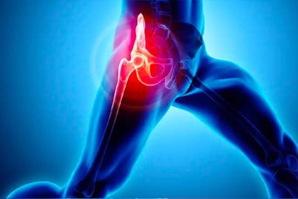 prothese hanche dr zadegan chirurgien orthopediste chirurgie orthopedique hanche genou paris prothese hanche dr zadegan chirurgien orthopediste chirurgie orthopedique hanche genou paris